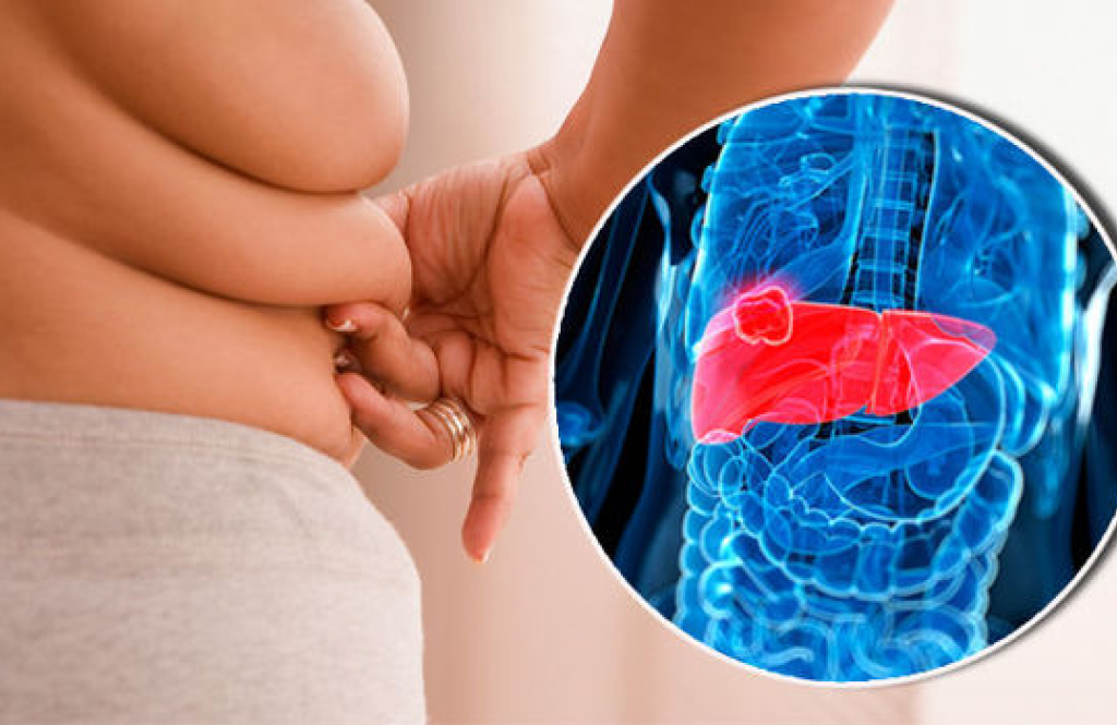 Endocrine