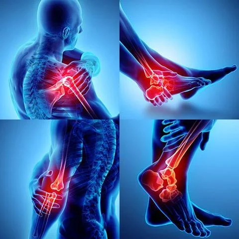 Joint Pain
